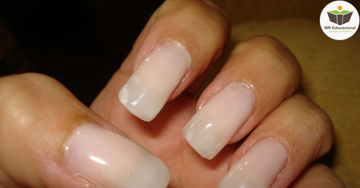 UNHAS DE GEL