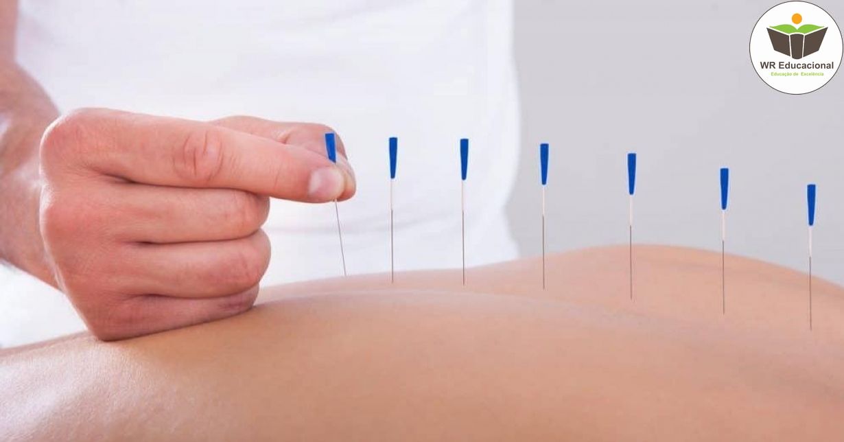 NOÇÕES BÁSICAS DA ACUPUNTURA CHINESA