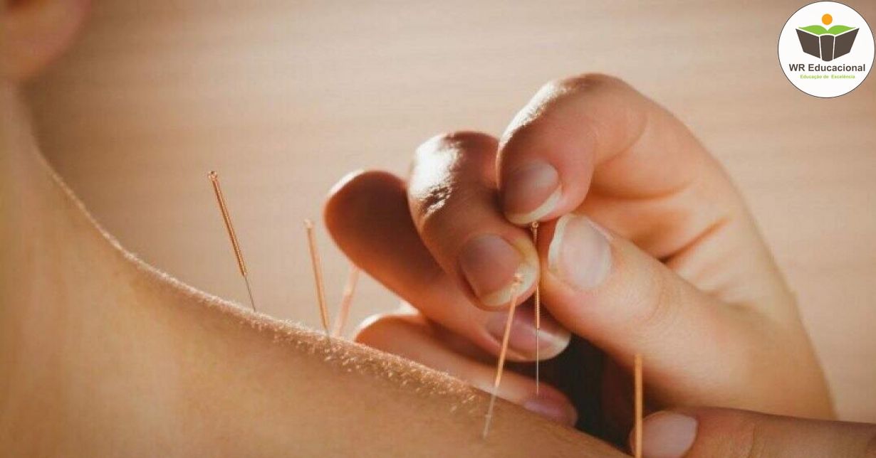 NOÇÕES BÁSICAS DA AURICULOTERAPIA NA REDUÇÃO DA ANSIEDADE
