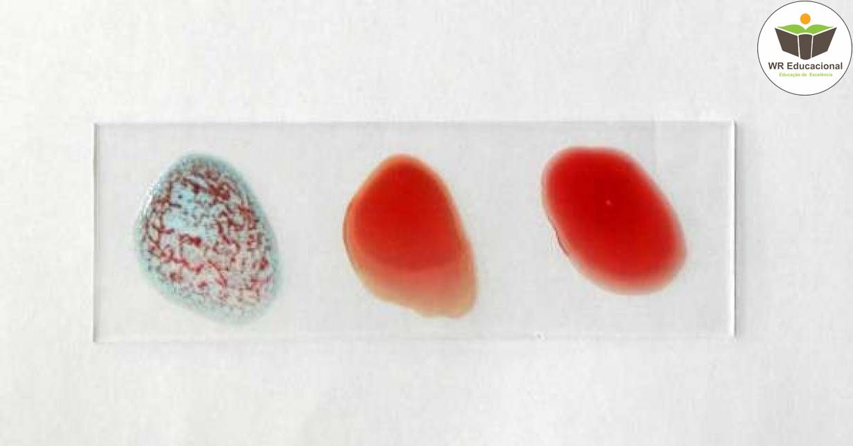 NOÇÕES BÁSICAS EM AUXILIAR DE IMUNOHEMATOLOGIA